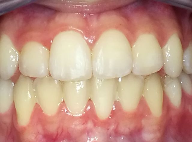 Clínica Dental Dr. Bienvenido Pérez Mombiela tratamientos de ortodoncia